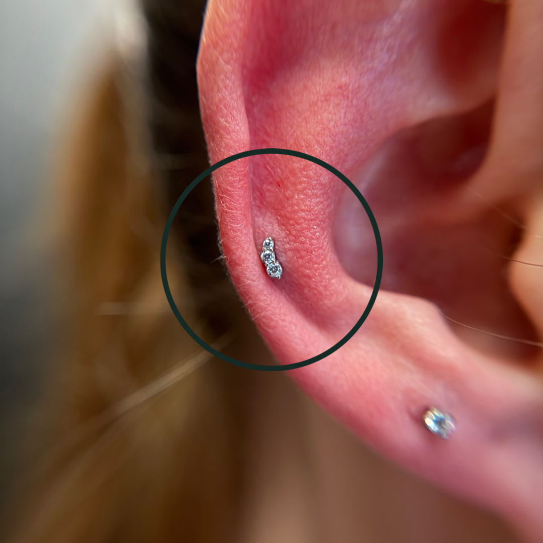 Helix